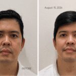 MOLD Manila Shares Three-Month Patient Results From XERF Skin Tightening